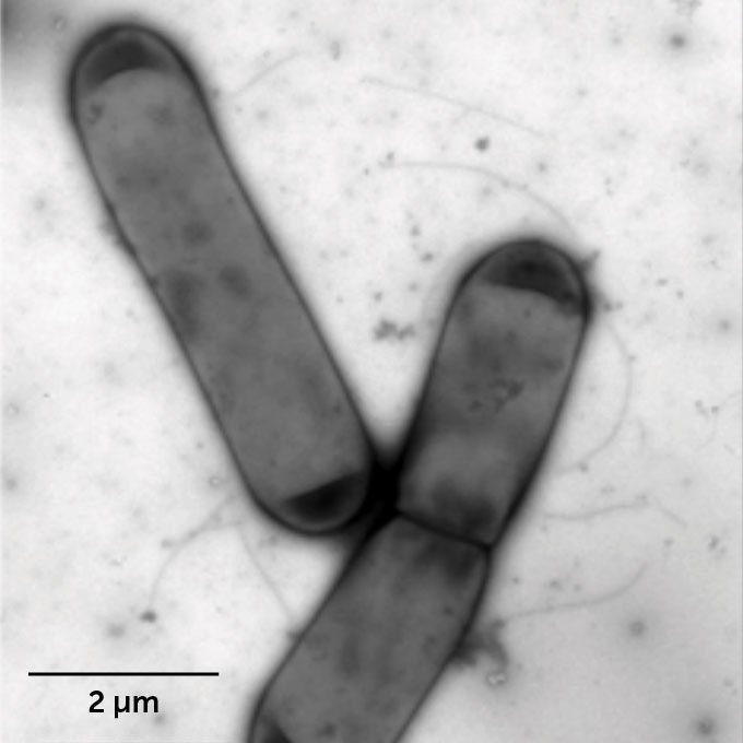 black and white X-ray image of two C. difficile’s bacteria where the outer surface is visible